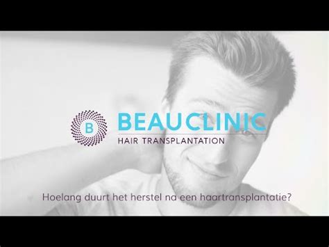 Hoelang Duurt Het Herstel Na Een Haartransplantatie?